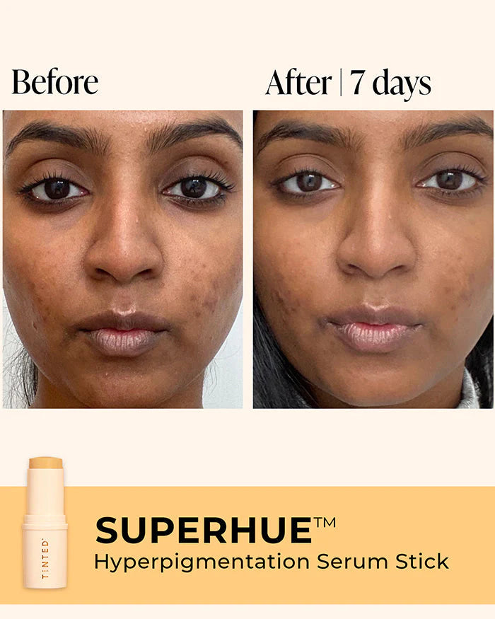 Live Tinted Superhue Hyperpigmentation Stick