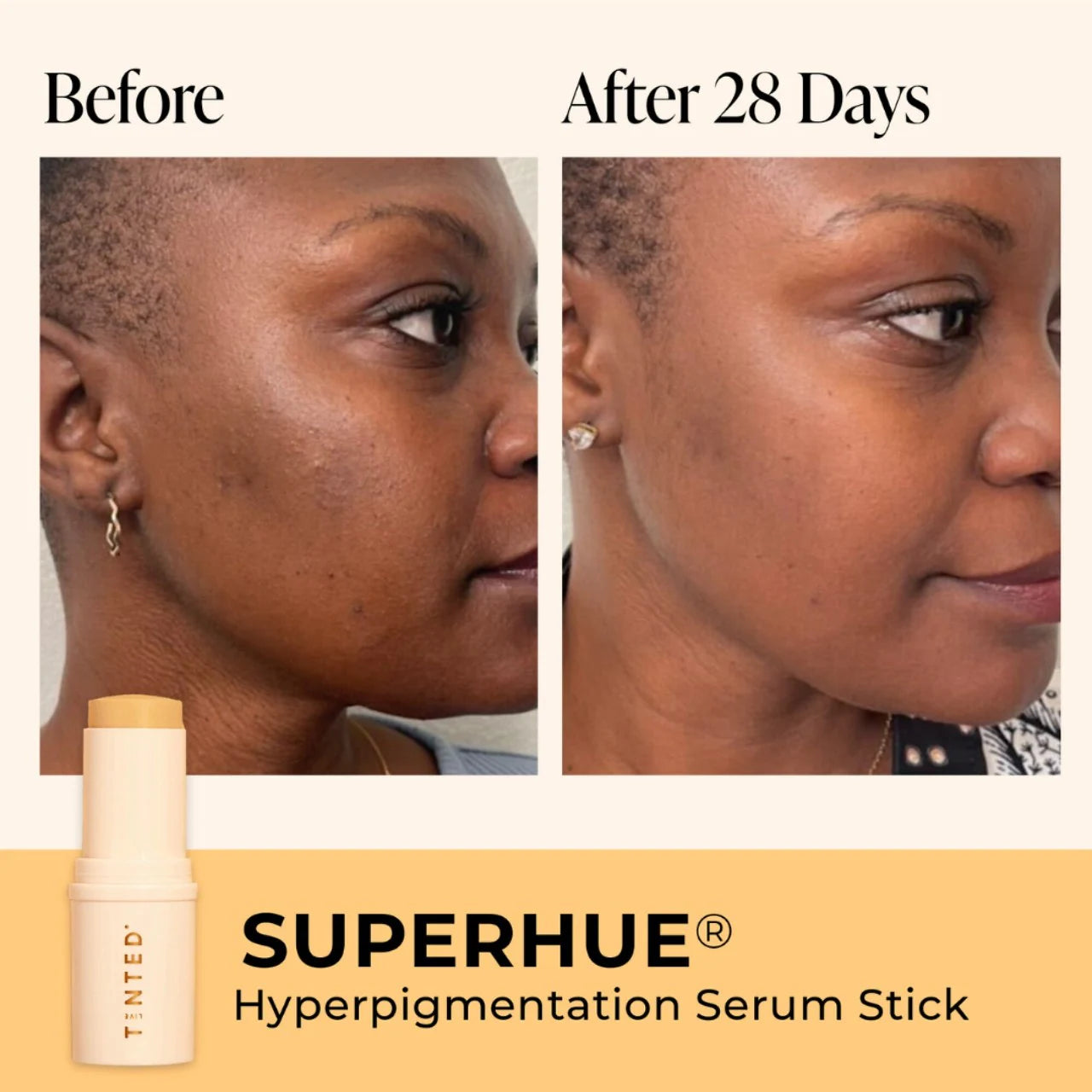 Live Tinted Superhue Hyperpigmentation Stick